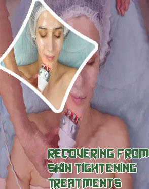 Face skin tightening treatment