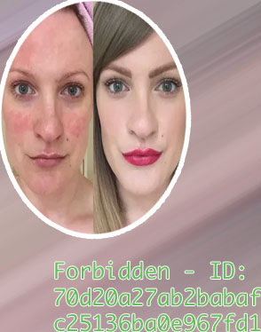 Primer for rosacea